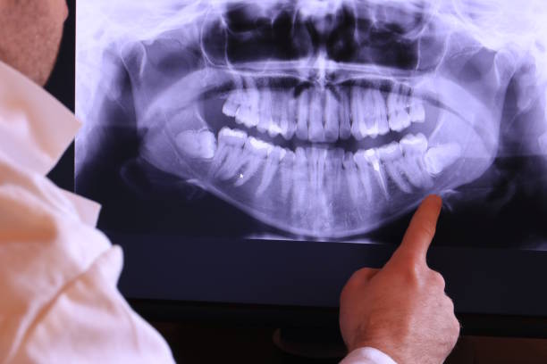 Best Dentist for Tooth Abscess  in Glasgow, MT